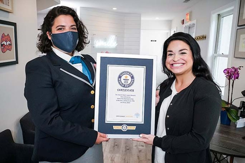 Guinness Rekorlar kitabına ‘Dünyanın en büyük ağızlı kadını’ olarak girdi - 8